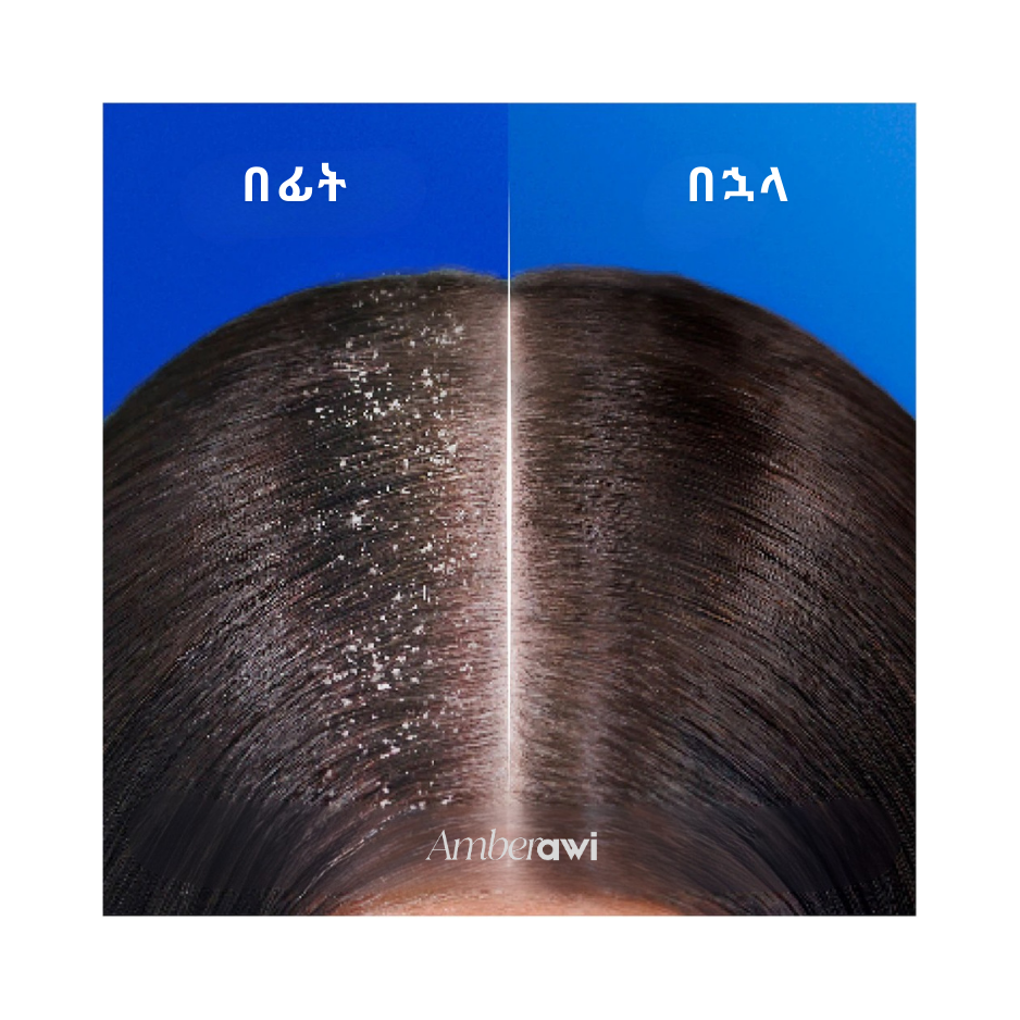 Head & Shoulders Classic Clean