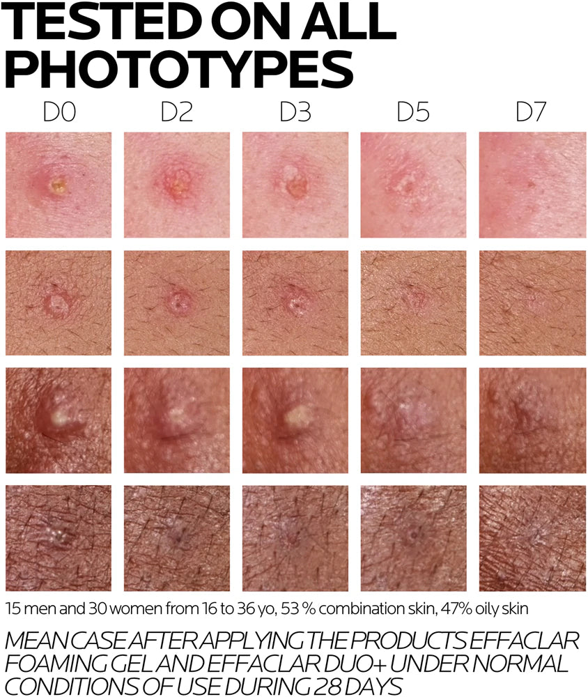 La Roche-Posay Effaclar DUO (+M)