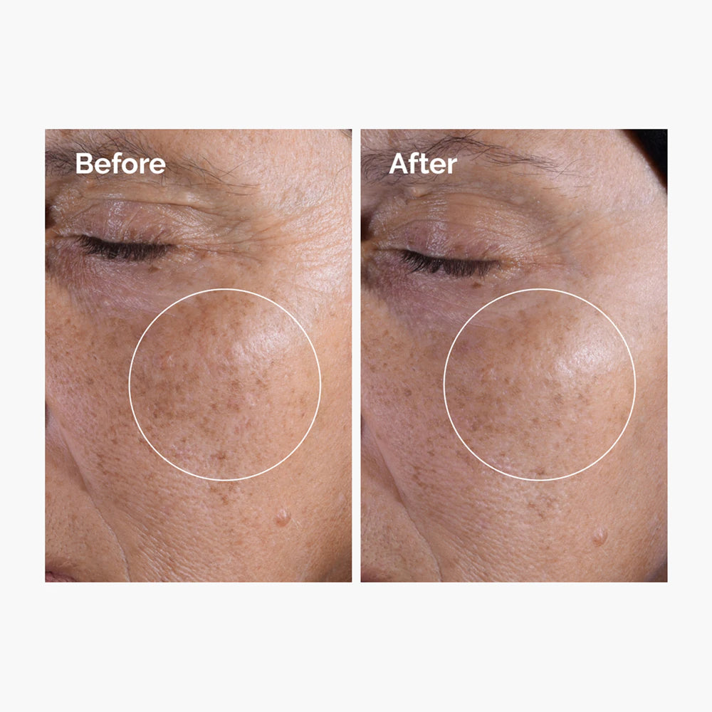 The Ordinary Glycolic Acid 7% Exfoliating Toner 100ml